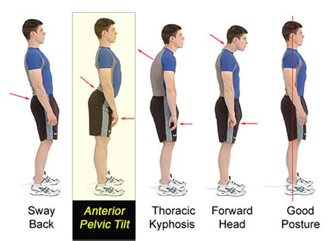 How To Retain A Proper Posture When Sitting Standing Walking