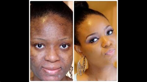 How To Cover Dryflaky Skin Quick Makeup Tip Youtube