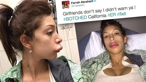 teen mom turned porn star farrah abraham tweets botched lips pic warns her girlfriends from the er