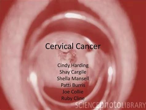 Ppt Cervical Cancer Powerpoint Presentation Free Download Id2361602