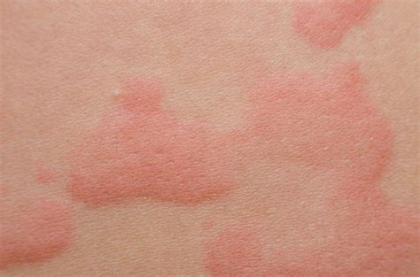 10 Unusual Skin Problems That Could Be A Sign Of A Serious Disease