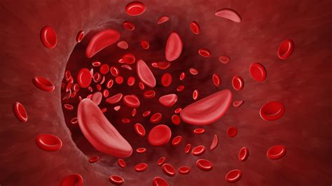 Quem Tem Traços De Anemia Falciforme Pode Doar Sangue