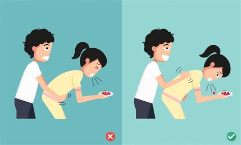 Wrong And Right Ways First Aidman Giving Choking Womanillustration Vector Premium Download