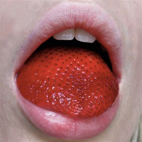 Scarlet Fever Tongue