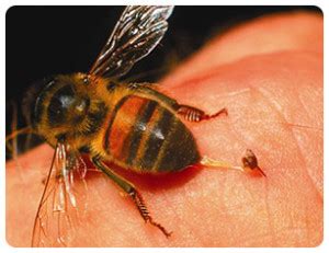 This will help minimize the pain. Top Home Remedies for Yellow Jackets Stings - The Complete ...