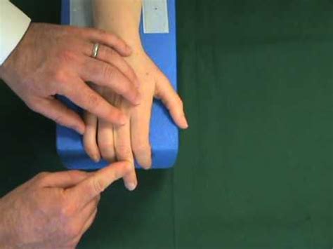 Our website is for educational purposes only. Boutonniere Deformity - Hand - Orthobullets