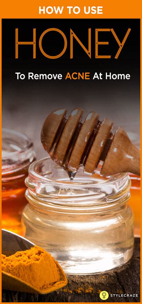 how to use honey to remove acne at home diy