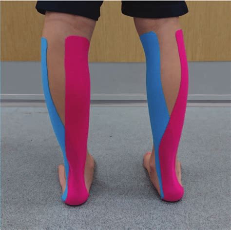 Kinesio Tape Application On The Gastrocnemius Muscle Download