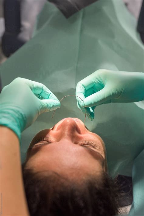 orthodontist fixing dental braces to patient by stocksy contributor ibex media stocksy