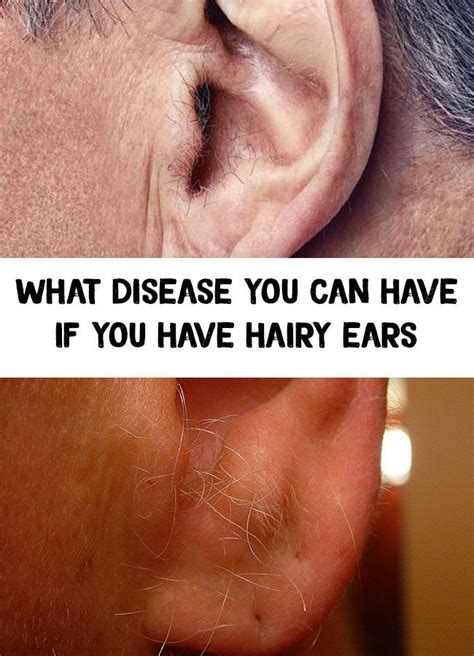 Hairy Ears What Disease You Can Have If You Have Hairy Ears Hairy