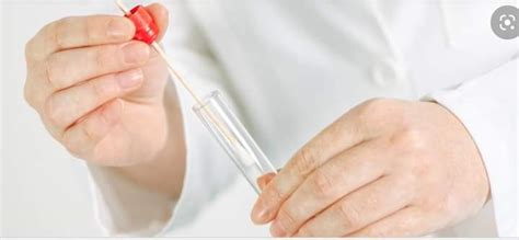 Hasil pemeriksaaan pap smear di rumah. Tak Payah Risau 'Muncung Itik' Lagi, Ujian HPV DNA Kini ...