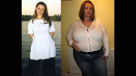 Woman Weight Gain Before After