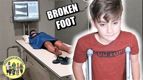 Kid Breaks His Ankle Playing Soccer A Doctor Says His Foot Is Broken