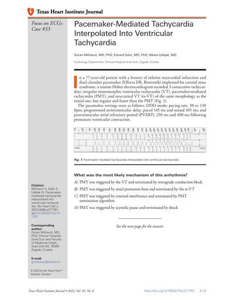 Pdf Pacemaker Mediated Tachycardia Interpolated Into Ventricular
