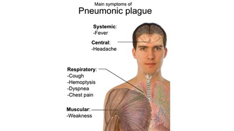 Pneumonic Plague Pictures