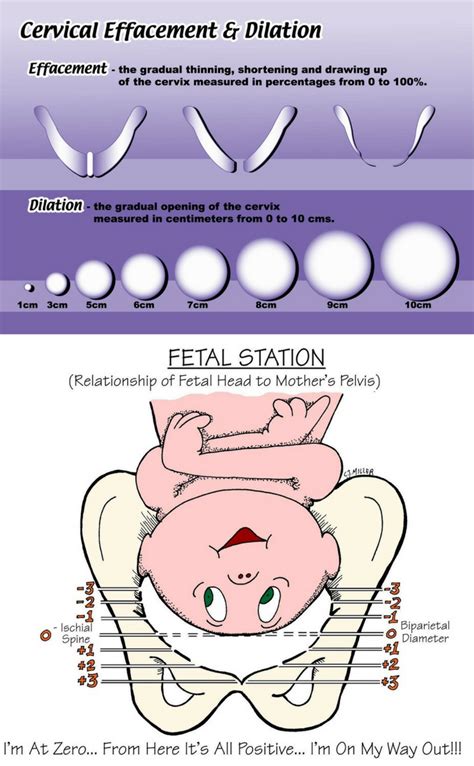 Cervical Effacement And Dilation Chart With Fetal Station Image My