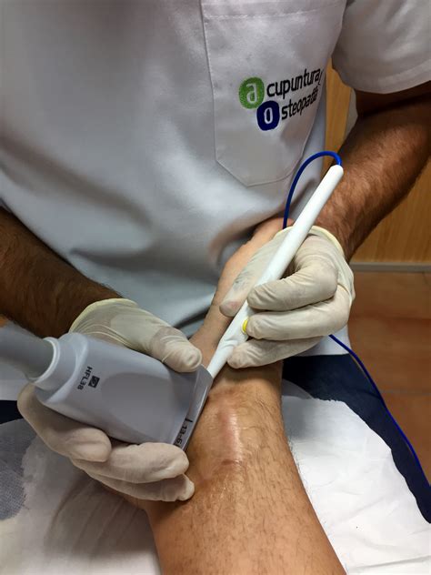 Epi Electrolisis Percut Nea Intratisular Centro De Acupuntura En Sabadell Acupuntura Y