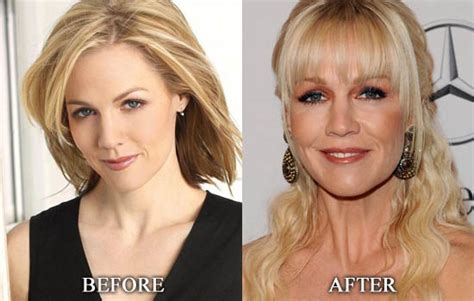 Jennie Garth Plastic Surgery Before And After Pictures