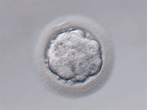How Is An Embryo Selected My Fertility Care Fertility Specialist
