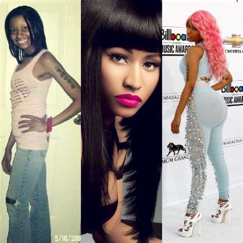 Nicki Minaj Surgery Pictures Before And After The Meta Pictures