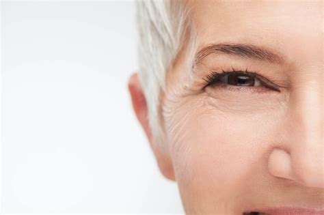 Eye Wrinkles Brisbane Skin Dermatologist