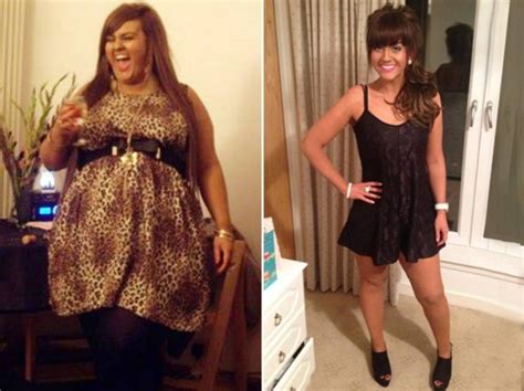 Uk Woman Loses 9 Stone After Weight Loss Surgery Gastric Band Paid By