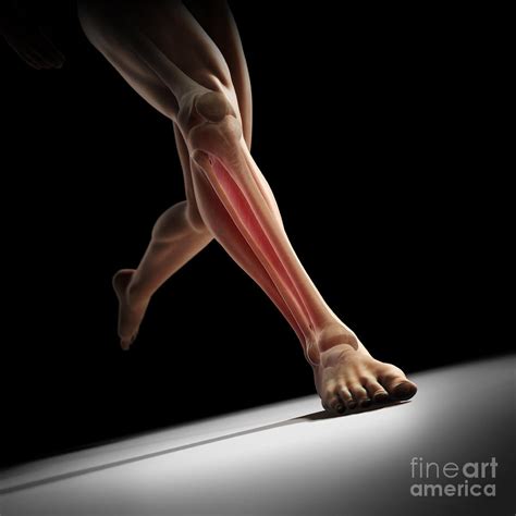 Medial Tibial Stress Syndrome Photograph By Science Picture Co Fine