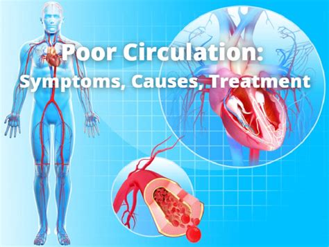 Poor Circulation Symptoms Causes Treatment