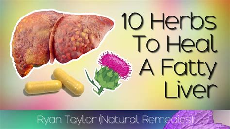 Top 10 Herbs For Fatty Liver Disease Natural Remedies Youtube
