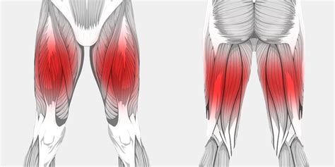 Front Leg Musclevtendon Thigh Muscle Strains Florida Orthopaedic