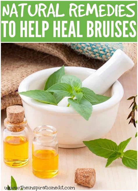 Ways To Get Rid Of Bruises Using Natural Remedies · The Inspiration Edit