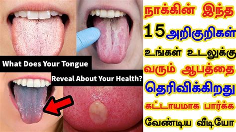 15 Signs Of Your Tongue Tested In 7 Mins15 Tongue Signs Your Body Is Asking Forhelpwith