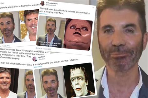 Fans Worry About Simon Cowell After He Looks Unrecognizable What Happened To His Face
