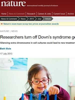 A síndrome de down (sd) é uma alteração genética produzida pela presença de um cromossomo a mais, o par 21, por isso também conhecida como trissomia 21. Cientistas silenciam cromossomo que causa Síndrome de Down ...