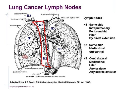 Tnm Staging Of Lung Cancer 7 Th Edition