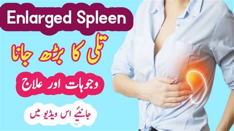 Enlarged Spleen Treatment In Urdu Enlarged Spleen تلی کا بڑھ جانا