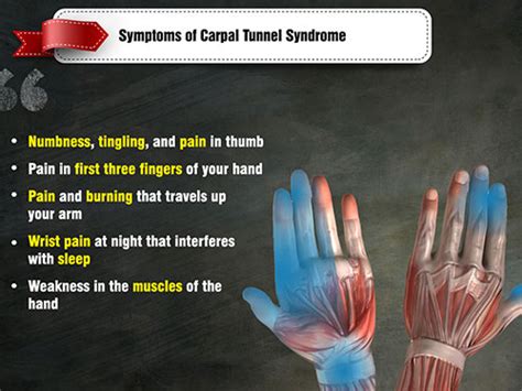 Carpal Tunnel Syndrome Causes Symptoms And Treatment Gloves Mag My