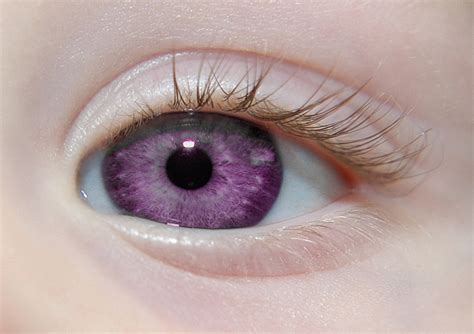 Purple Eye My Baby Cousins Eye One Hundred And Fifty Thou Flickr