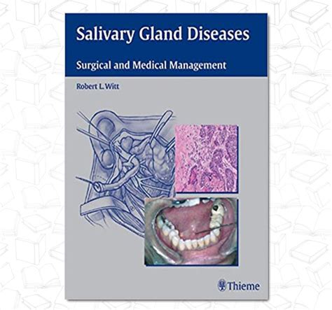Salivary Gland Diseases Surgical And Medical Management Dent13