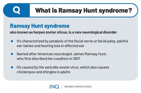 Ramsay Hunt Syndrome What To Know About Whats Ailing Justin Bieber