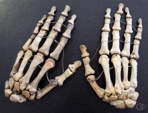 Скелет Ноги Человека Фото Telegraph