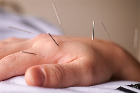 Wellness Acupuncture For Better Sex And Less Stress Smartshanghai