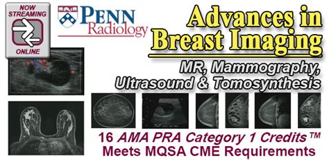 Penn Radiology Advances In Breast Imaging 2014 Cme Videos Afkebooks Medical Ebooks For Doctors