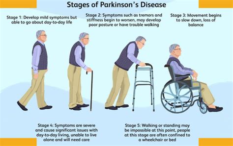 Exploring The 5 Stages Of Parkinsons Disease