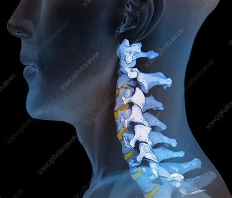 Normal Neck Bones 3d Ct Scan Stock Image F0069115 Science Photo