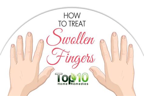 How To Treat Swollen Fingers Top 10 Home Remedies
