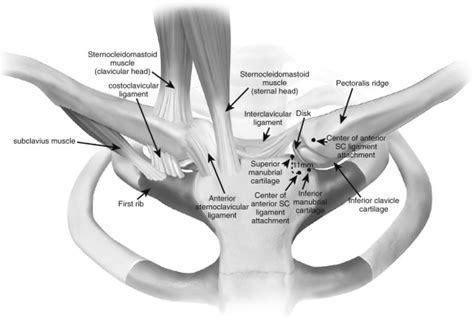 Disorders Of The Sternoclavicular Joint Musculoskeletal Key