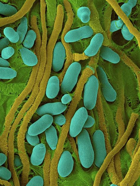 Fungus Acremonium Stromaticum Photograph By Dennis Kunkel Microscopy