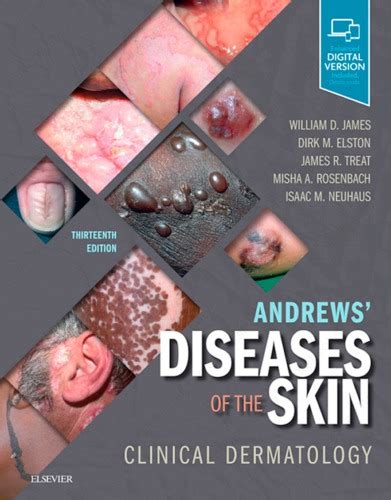 Andrews Diseases Of The Skin Clinical Dermatology 13th Edition