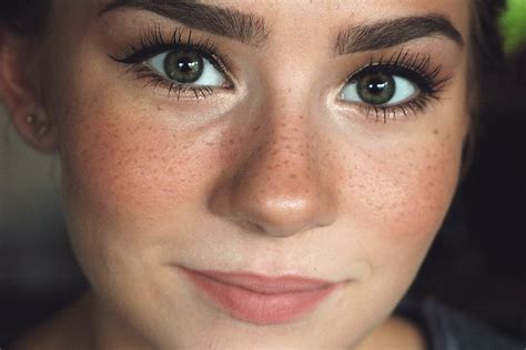 Freckle Faced Facial